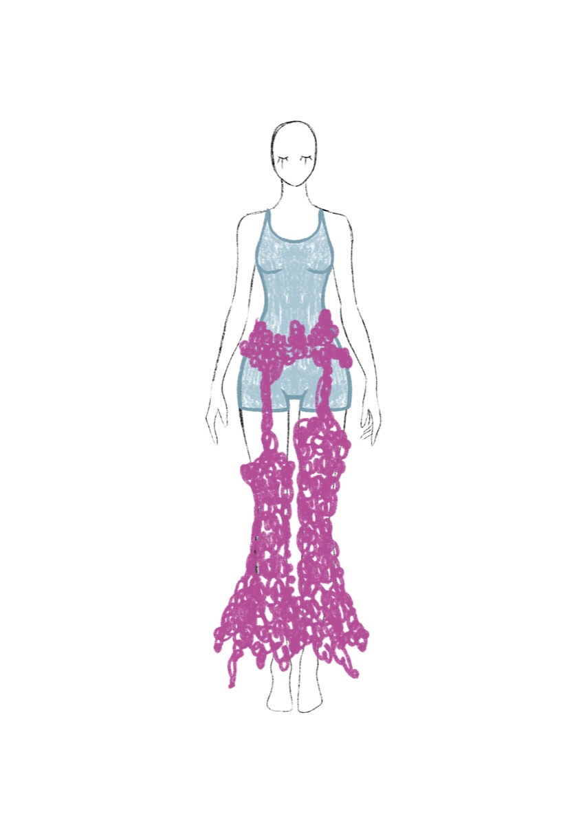Jellyfish